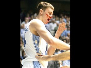 Tyler Hansbrough Ultimate Nude And Sexy Collection