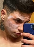 ADRIAN BLANCO